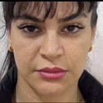 کلینیک زیبایی الماس کاملا اقساطی