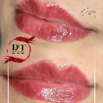 مرکز میکروبلیدینگ شیدینگ ریموو اسکالپ