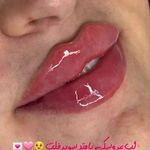 کلینیک زیبایی شایلی