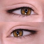 مرکز میکروبلیدینگ وفیبروز فرشته تقی زاده