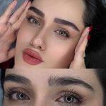 میکروبلیدینگ تخصصی زهرابدلی