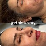 کلینیک زیبایی فشیال دکتر هدیه دهقان پور