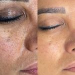 خدمات و آموزش تخصصی فیشیال فرزانه