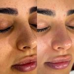 خدمات و آموزش تخصصی فیشیال فرزانه