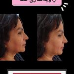 مرکز تخصصی زیبایی و سلامت پوست و مو شبنم