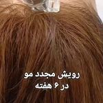 مرکز تخصصی زیبایی و سلامت پوست و مو شبنم