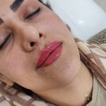 کلینیک زیبایی رز سفید