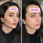 کلینیک پوست و زیبایی ژیلاوَش