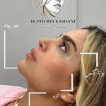 کلینیک زیبایی رز سفید (دکتر کاشانی)