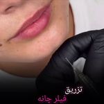 کلینیک پوست و زیبایی ژیلاوَش