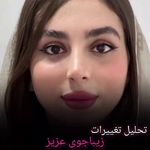 کلینیک پوست و زیبایی ژیلاوَش