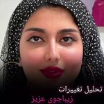 کلینیک پوست و زیبایی ژیلاوَش