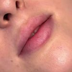 کلینیک پوست و زیبایی ژیلاوَش