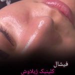 کلینیک پوست و زیبایی ژیلاوَش