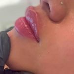 کلینیک پوست و زیبایی ژیلاوَش