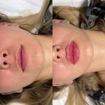 کلینیک پوست و زیبایی ژیلاوَش