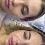 کلینیک پوست و زیبایی ژیلاوَش