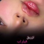 کلینیک پوست و زیبایی ژیلاوَش