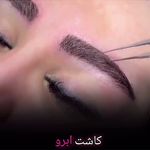 کلینیک پوست و زیبایی ژیلاوَش