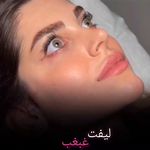 کلینیک پوست و زیبایی ژیلاوَش