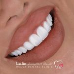 کلینیک دندانپزشکی هلسا(اقساط)
