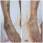 فیشال و پاکسازی پوست درنواب