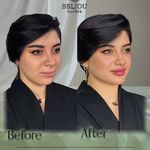 کلینیک زیبایی بلژو