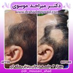 دکترمیراحدموسوی