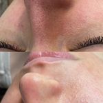 خدمات پاکسازی پوست فیشیال
