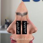 کلینیک زیبایی و لیزر دکتر آزاده اسماعیلی