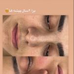 کلینیک فیشال و ماساژ سارن اسکین سارا