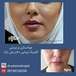 کلینیک زیبایی دکترولی نژاد