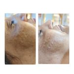 پاکسازی پوست وفیشال تخصصی فاطیما