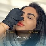 مطب پوست، مو و زیبایی و لیزر شبیرا