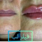 مرکز لیزرو کلینیک زیبایی طراوت