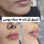 کلینیک پوست،مو،زیبایی،مرکز لیزر ‌پرنسا