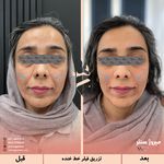 مرکز پزشکی و زیبایی میروژ سنتر