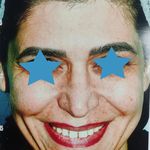 جراح بینی دکتر مسعود ملکی