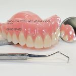 لابراتوار دندانسازی دندان مصنوعی ژله ای نایت گارد دندان سازی ایمپلنت نایتگارد