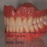 لابراتوار دندانسازی دندان مصنوعی ژله ای نایت گارد دندان سازی ایمپلنت نایتگارد