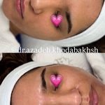 مطب زیبایی آرا