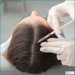 مزوتراپی علیرضا