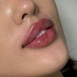 کلینیک لیزر پوست مو زیبایی الیزا شهرری