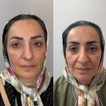 کلینیک لیزر و  زیبایی ملیح