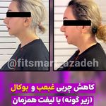 مرکز لاغری موضعی و ایکس بادی فیت اسمارت