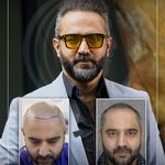 کلینیک پوست مو و زیبایی نوین ایرانا