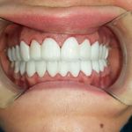 مطب ایمپلنت دکتر نیما شفیعی