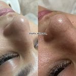 آموزشگاه و مرکز تخصصی پوست و موی قم