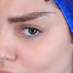 کلینیک زیبایی الماس کاملا اقساطی