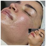 خدمات تخصصی پاکسازی پوست سحر